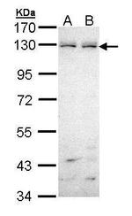 EphB6 Polyclonal Antibody