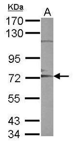 ADAM10 Polyclonal Antibody