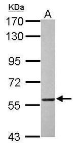 DNAJC3 Antibody in Western Blot (WB)