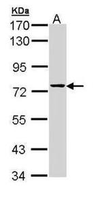 GRK6 Antibody in Western Blot (WB)