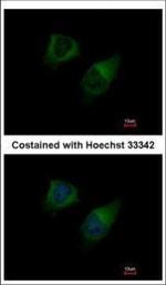 DGKG Polyclonal Antibody