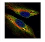PTK9 Polyclonal Antibody