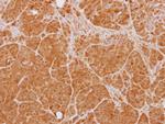 PTK9 Antibody in Immunohistochemistry (Paraffin) (IHC (P))