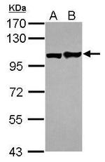 EphA1 Polyclonal Antibody