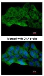 ZAK Polyclonal Antibody
