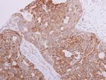 FASTKD3 Polyclonal Antibody