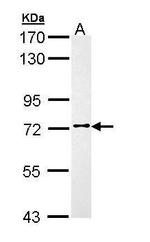 FASTKD3 Antibody in Western Blot (WB)