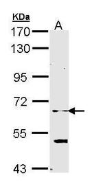 ELP3 Polyclonal Antibody