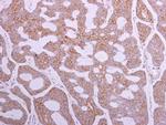 TRIP6 Polyclonal Antibody