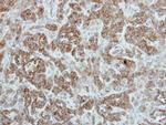 TRIP6 Antibody in Immunohistochemistry (Paraffin) (IHC (P))