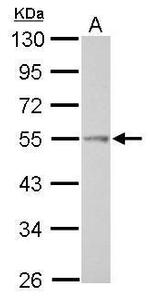 TRIP6 Antibody in Western Blot (WB)