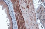 HK2 Antibody in Immunohistochemistry (Paraffin) (IHC (P))