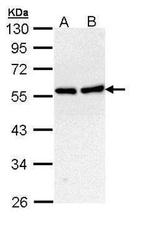 CaMKII beta Antibody in Western Blot (WB)
