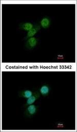 Lyn Polyclonal Antibody