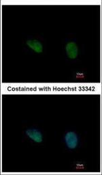 PHKG2 Polyclonal Antibody