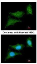 c-Raf Polyclonal Antibody