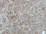 c-Raf Antibody in Immunohistochemistry (Paraffin) (IHC (P))