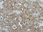 BCR Polyclonal Antibody