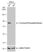 PFKM Antibody in Western Blot (WB)