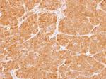 PKC zeta Polyclonal Antibody