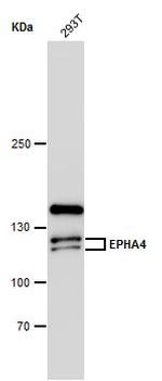 EphA4 Antibody in Western Blot (WB)