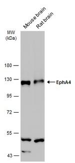 EphA4 Antibody in Western Blot (WB)