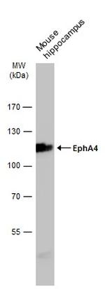 EphA4 Antibody in Western Blot (WB)