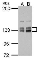 PPIP5K2 Antibody in Western Blot (WB)
