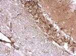 Drebrin Polyclonal Antibody