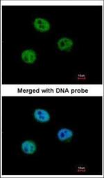 MSH6 Polyclonal Antibody