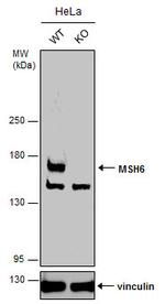 MSH6 Antibody in Western Blot (WB)