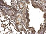 IGF1R Antibody in Immunohistochemistry (Paraffin) (IHC (P))