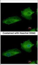 TGM2 Antibody in Immunocytochemistry (ICC/IF)