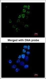XRCC1 Polyclonal Antibody