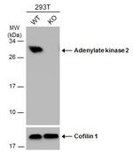Adenylate Kinase 2 Antibody in Western Blot (WB)