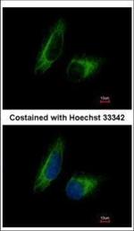 PFKFB1 Polyclonal Antibody