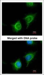 Adenylate Kinase 2 Polyclonal Antibody