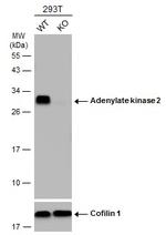 Adenylate Kinase 2 Antibody in Western Blot (WB)