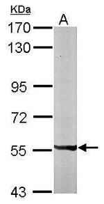 PXK Polyclonal Antibody