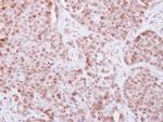 ELP4 Antibody in Immunohistochemistry (Paraffin) (IHC (P))