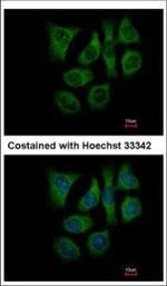 GALK2 Polyclonal Antibody
