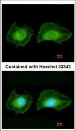 SGK3 Polyclonal Antibody