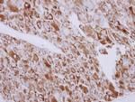 SGK3 Antibody in Immunohistochemistry (Paraffin) (IHC (P))