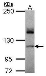SERCA2 ATPase Antibody in Western Blot (WB)