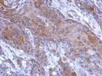 Calpain 2 Antibody in Immunohistochemistry (Paraffin) (IHC (P))