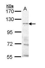 TRPM8 Polyclonal Antibody