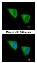 GCLM Polyclonal Antibody