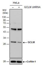 GCLM Antibody in Western Blot (WB)