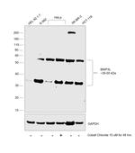 BNIP3L Antibody in Western Blot (WB)
