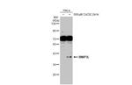BNIP3L Antibody in Western Blot (WB)